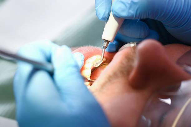 Best Tooth Pain Emergency Relief  in Minier, IL