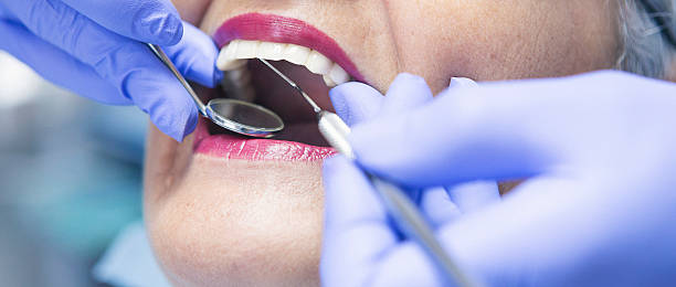 Best Root Canal Emergency Dentist  in Minier, IL